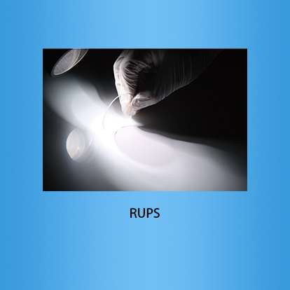 分光平片：RUPS